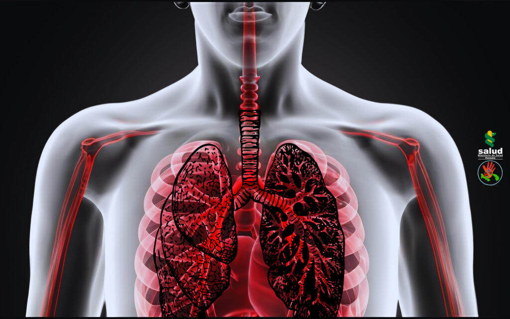 Tabaco y tuberculosis